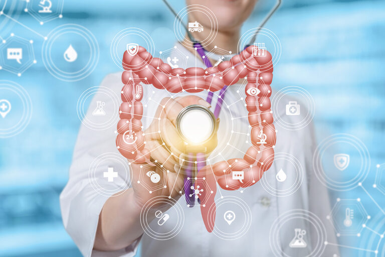 Multifaktorielle Erkrankungen – Funktionelle Dyspepsie und Reizdarmsyndrom