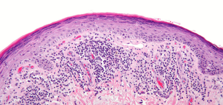 Über den Tellerrand schauen