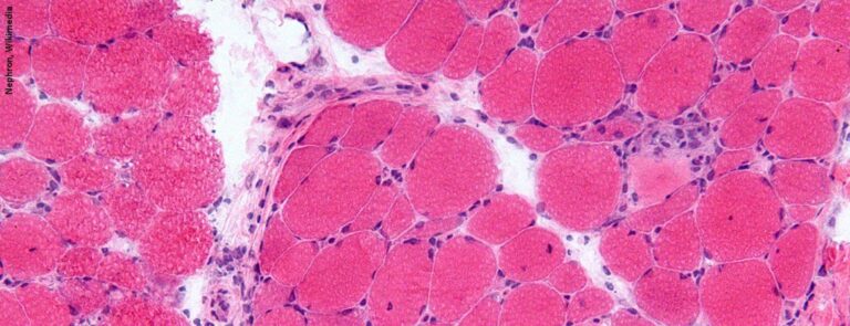 Gestörte mitochondriale Funktion als Trigger für ISG-Hochregulierung?
