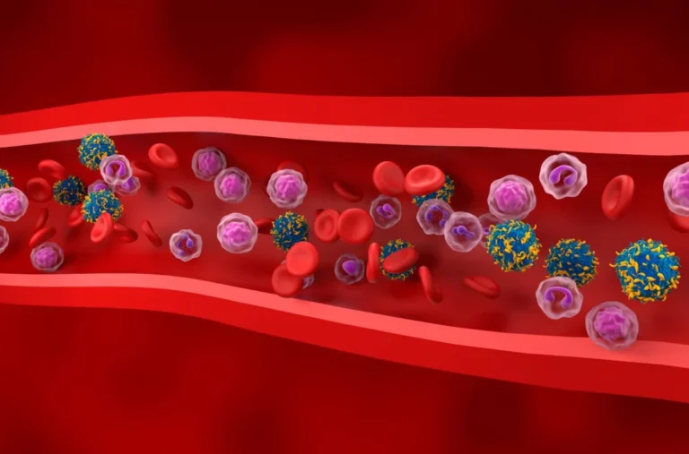 CAR-T-Zelltherapie bei hämatologischen Krebserkrankungen
